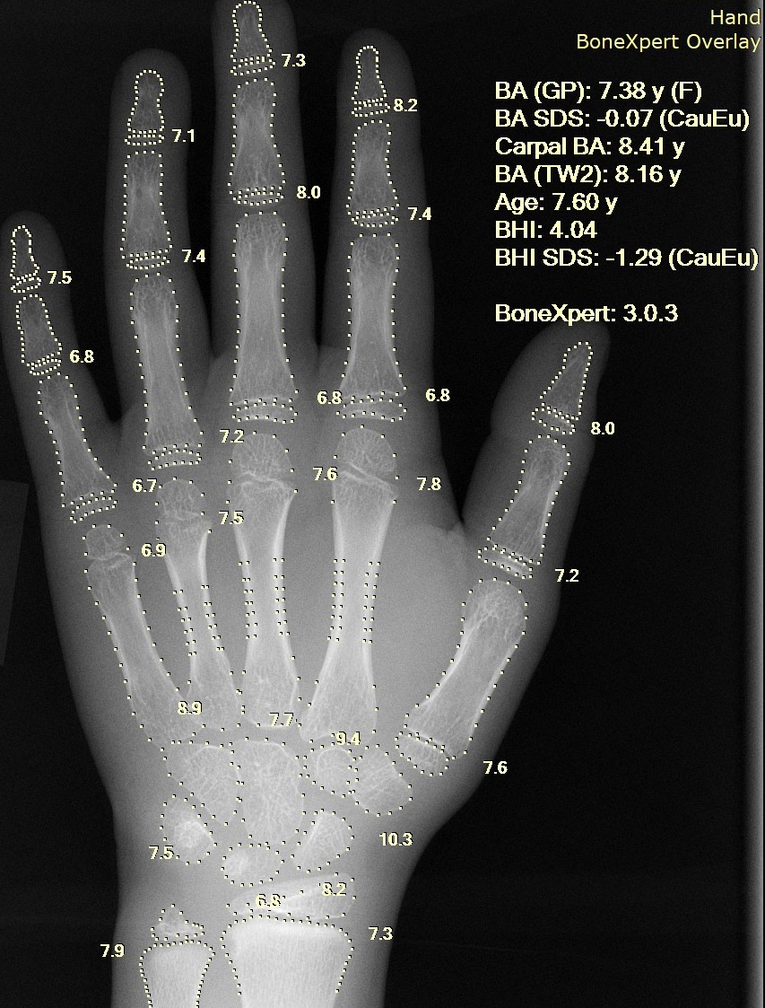Portrait de Alignment Healthcare