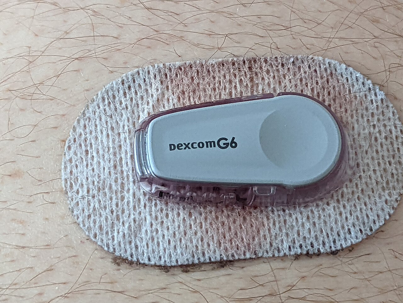 Portrait de DexCom